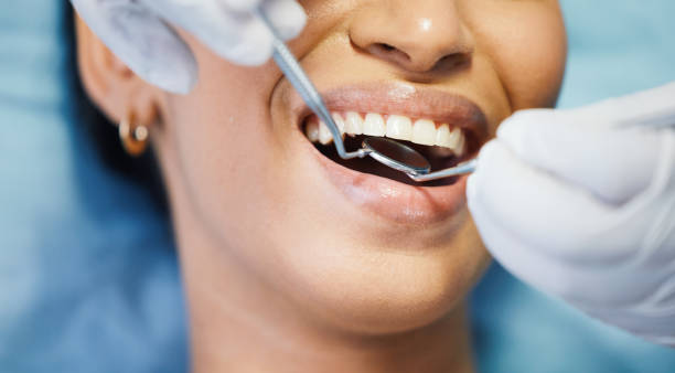 Trusted CA Emergency Dentist Experts