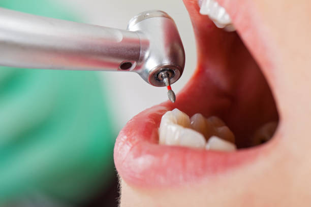 Best Urgent Tooth Repair  in Sutter Creek, CA